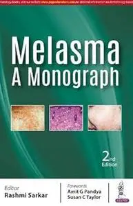 Melasma: A Monograph Ed 2