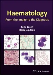 Haematology: From the Image to the Diagnosis