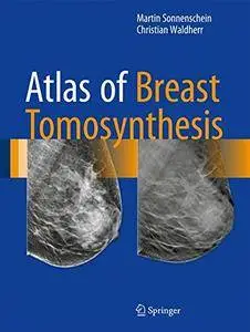 Atlas of Breast Tomosynthesis: Imaging Findings and Image-Guided Interventions (repost)