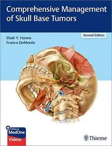 Comprehensive Management of Skull Base Tumors, 2nd Edition