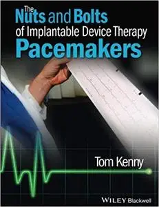 The Nuts and Bolts of Implantable Device Therapy: Pacemakers