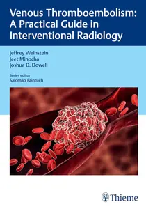 Venous Thromboembolism: A Practical Guide in Interventional Radiology