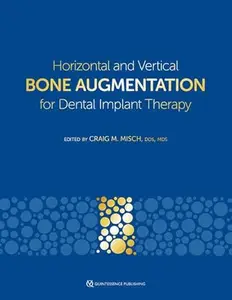 Horizontal and Vertical Bone Augmentation for Dental Implant Therapy