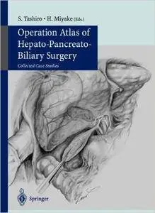 Operation Atlas of Hepato-Pancreato-Biliary Surgery: Collected Case Studies (Repost)