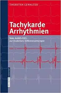 Tachykarde Arrhythmien: Vom Anfalls-EKG zur modernen Differentialtherapie (Repost)