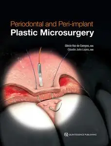 «Periodontal and Peri-implant Plastic Microsurgery» by Cláudio Julio Lopes, Glécio Vaz de Campos