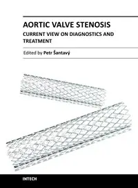 Aortic Valve Stenosis – Current View on Diagnostics and Treatment by Petr Šantavý