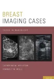 Breast Imaging Cases (Cases in Radiology) (repost)