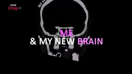 BBC - Me and My New Brain (2015)
