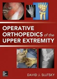 Operative Orthopedics of the Upper Extremity (repost)