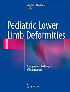 Pediatric Lower Limb Deformities: Principles and Techniques of Management (Repost)