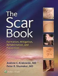 The Scar Book: Formation, Mitigation, Rehabilitation and Prevention