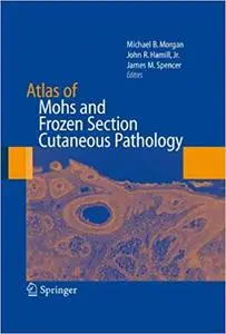 Atlas of Mohs and Frozen Section Cutaneous Pathology