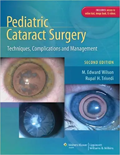 Pediatric Cataract Surgery: Techniques, Complications and Management (Repost)