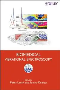 Biomedical Vibrational Spectroscopy (Repost)