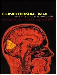 Functional MRI: An Introduction to Methods (repost)