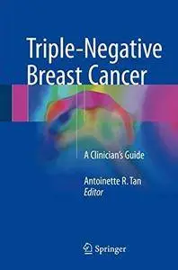 Triple-Negative Breast Cancer: A Clinician’s Guide [Repost]