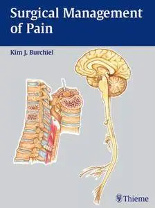 Surgical Management of Pain