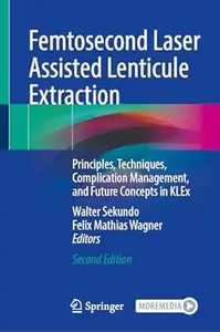 Femtosecond Laser Assisted Lenticule Extraction (2nd Edition)