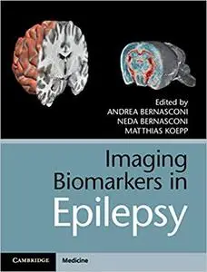 Imaging Biomarkers in Epilepsy