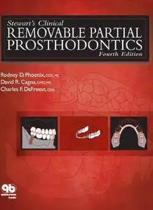 Stewart’s Clinical Removable Partial Prosthodontics, 4th Edition