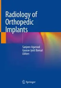 Radiology of Orthopedic Implants (Repost)