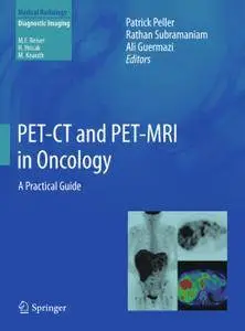 PET-CT and PET-MRI in Oncology: A Practical Guide