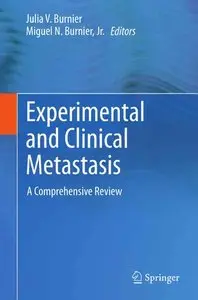 Experimental and Clinical Metastasis: A Comprehensive Review (Repost)