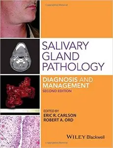 Salivary Gland Pathology Diagnosis and Management (2nd Edition)
