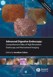 Comprehensive Atlas of High Resolution Endoscopy and Narrowband Imaging (repost)