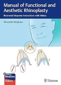 Manual of Functional and Aesthetic Rhinoplasty: Illustrated Stepwise Instructions with Videos