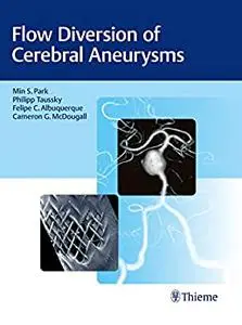 Flow Diversion of Cerebral Aneurysms