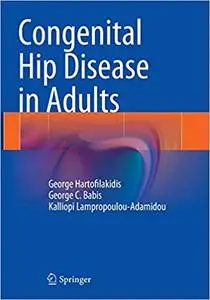 Congenital Hip Disease in Adults (Repost)