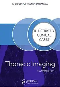 Thoracic Imaging: Illustrated Clinical Cases, Second Edition