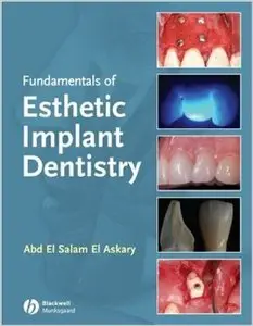 Fundamentals of Esthetic Implant Dentistry, 2nd Edition