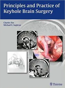 Principles and Practice of Keyhole Brain Surgery (repost)