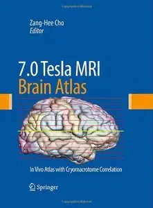 7.0 Tesla MRI Brain Atlas: In Vivo Atlas with Cryomacrotome Correlation (Repost)