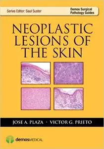 Neoplastic Lesions of the Skin (Repost)
