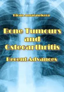 "Bone Tumours and Osteoarthritis: Recent Advances" ed. by Hiran Amarasekera