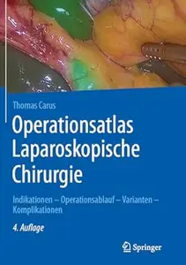 Operationsatlas Laparoskopische Chirurgie, 4. Auflage