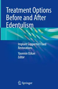 Treatment Options Before and After Edentulism: Implant Supported Fixed Restorations