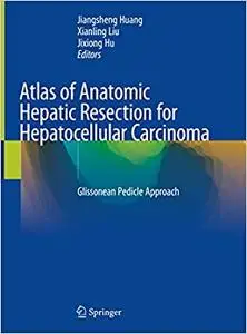 Atlas of Anatomic Hepatic Resection for Hepatocellular Carcinoma: Glissonean Pedicle Approach (Repost)