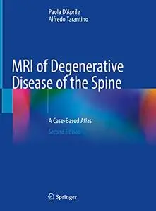 MRI of Degenerative Disease of the Spine, 2nd Edition