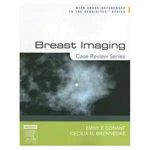 Breast Imaging: Case Review Series (repost)