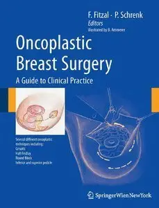 Oncoplastic Breast Surgery: A Guide to Clinical Practice (repost)