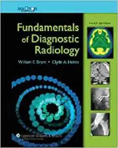 Fundamentals of Diagnostic Radiology (Brant, Fundamentals of Diagnostic Radiology)