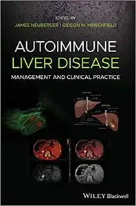 Autoimmune Liver Disease: Management and Clinical Practice