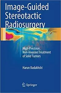 Image-Guided Stereotactic Radiosurgery: High-Precision, Non-invasive Treatment of Solid Tumors