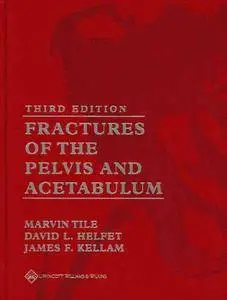 Fractures of the Pelvis and Acetabulum, Third edition