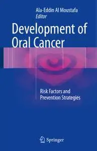 Development of Oral Cancer: Risk Factors and Prevention Strategies